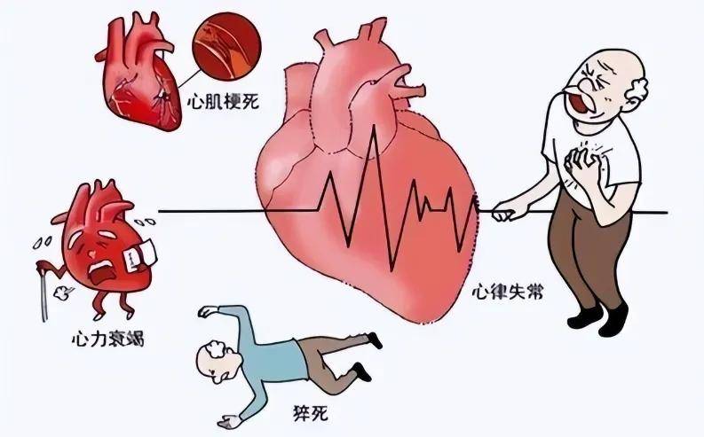 早期心力衰竭的表现一般不明显