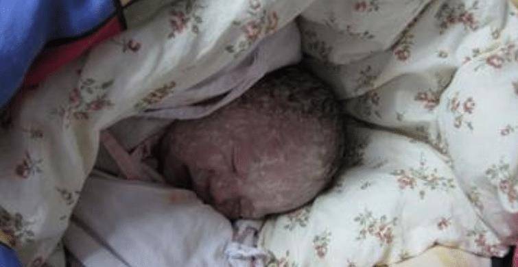 "丑宝宝"出生后被全家嫌弃,医生却说孩子好看,满月后出现奇迹