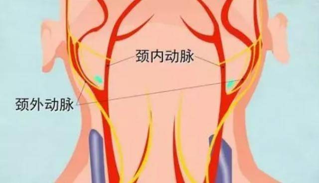 颈内动脉和颈外动脉图片