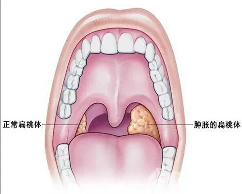 咽与喉的区别图片