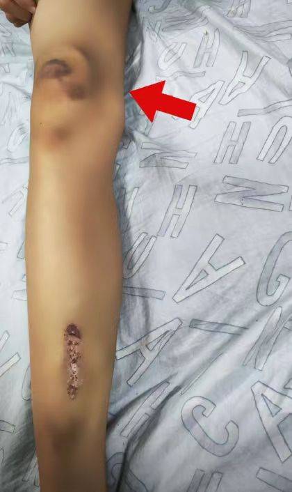 南通车祸去世女孩遗容已修复!妆容精致得体,其他伤者现状曝光