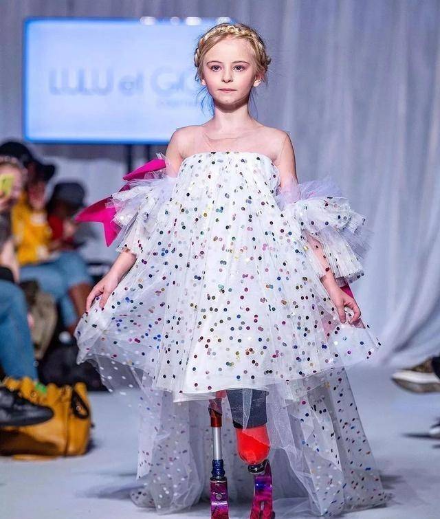 凤凰涅槃,9岁残疾女孩t台走秀,即使天生没腿照样可以光彩夺目