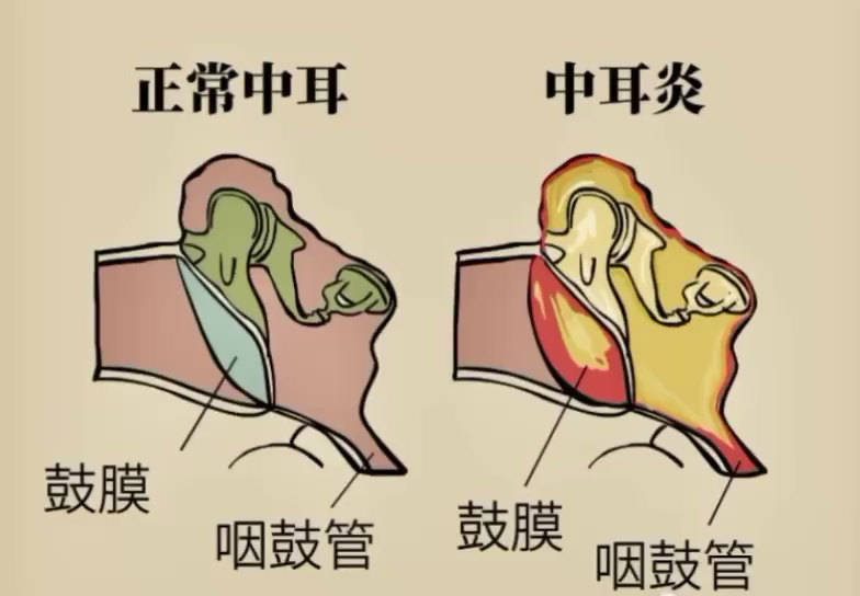 贵阳铭仁耳鼻喉医院专治中耳炎!
