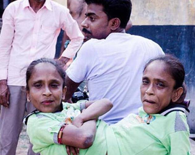 还记得印度"蜘蛛女"吗?走红后嫁给同一个男人生子,现状如何