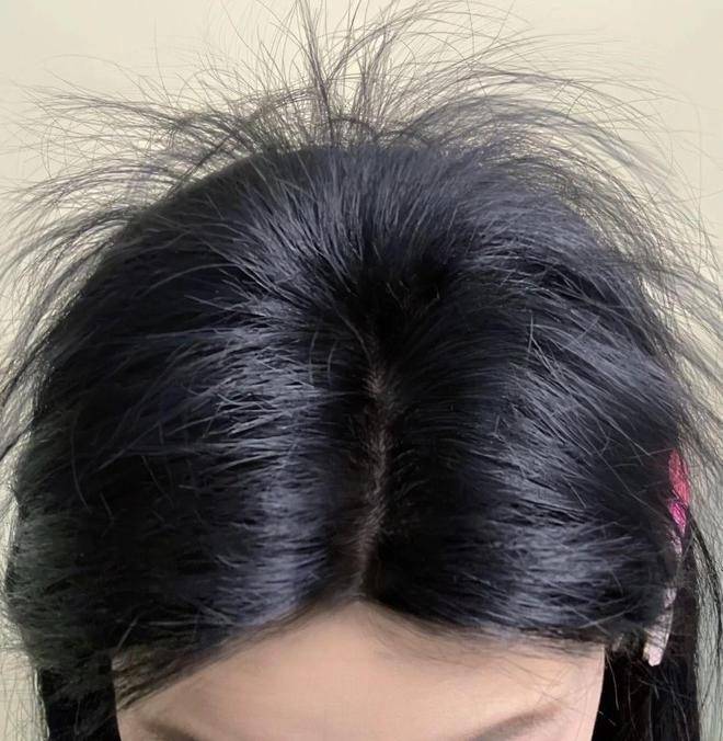 哪种育发液真的能生发?发量茂盛不难实现