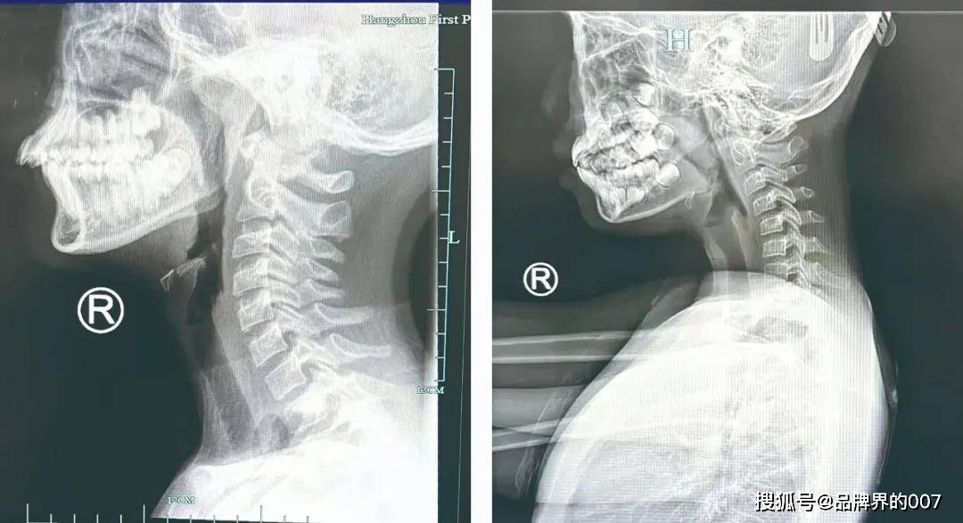 超2000人直呼过瘾,中老年玩剩的万亿项目,80%的年轻人才刚上手