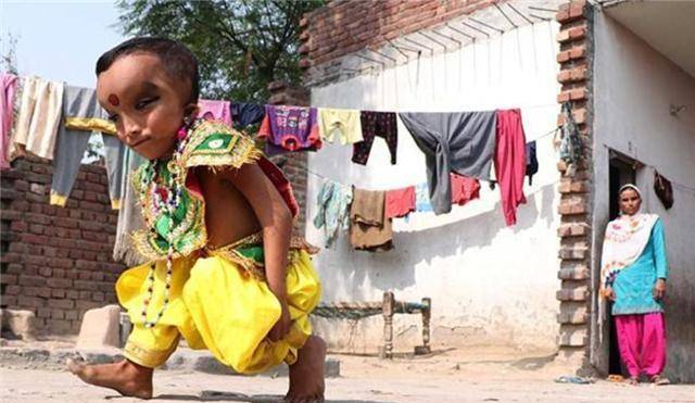 印度男孩长相奇特,被称"象头神童",被当地人供奉跪拜