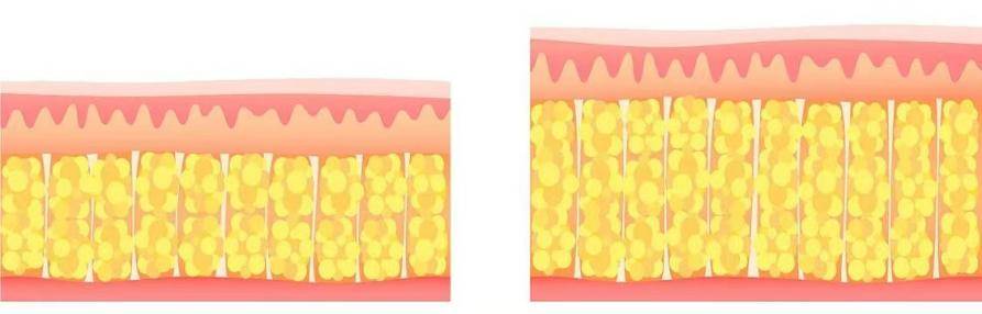 长春嘉和外科医院吸脂术前超声测量脂肪层 效果精准量化