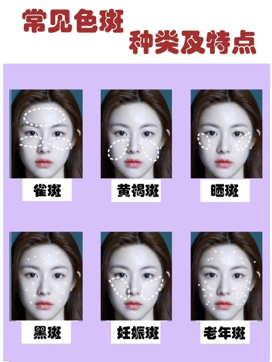 让阴唇变粉的方法_让阴唇变粉的方法_让阴唇变粉的方法