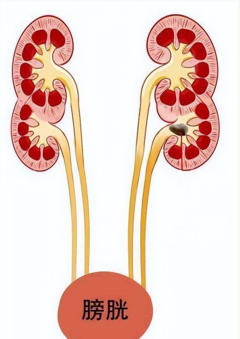 肾长啥样图片图片