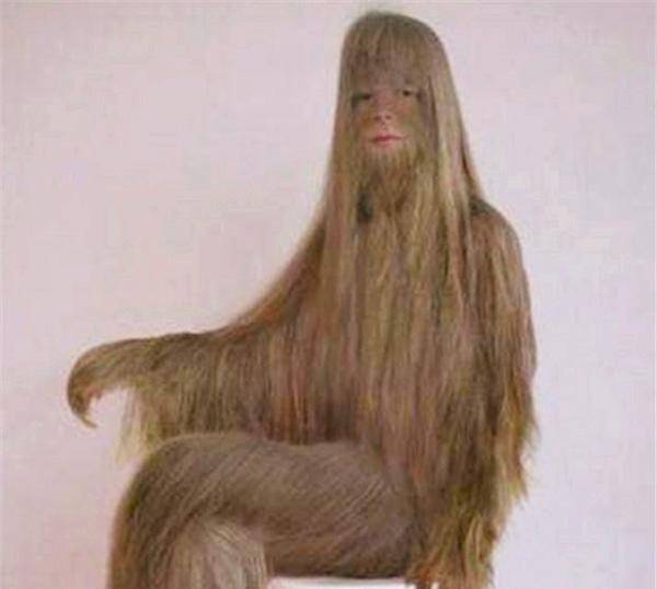 艾米丽·苏珊就是身上出现了返祖现象的一个女孩.