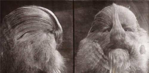 母亲醒来后,看到这宛如"小狮子"一样的婴儿,顿时也崩溃了,为了不让