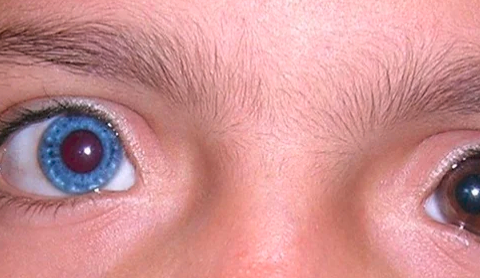 只要你善于观察,会发现有些人有不同颜色的眼睛,这是为什么呢?