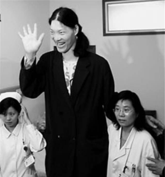 安徽"世界第一女巨人":穿78码鞋子,一顿能吃6碗面,41岁离世_姚德芬