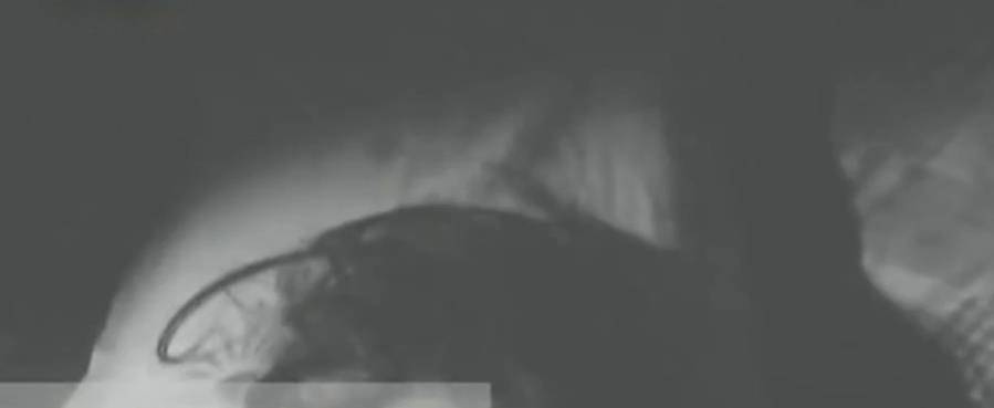 纪实：贵州一农村遇“鬼剃头”：村民一夜头发掉完，是什么在作怪-农村说的鬼剃头是怎么回事