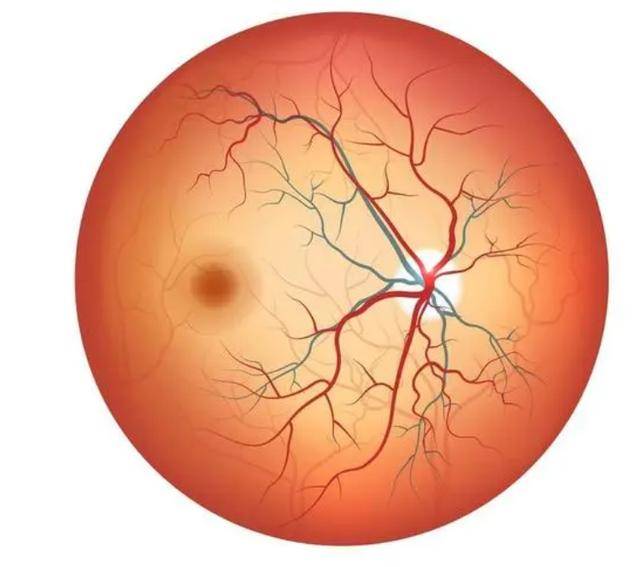 血管堵没堵看眼睛就能知道?医生:眼睛出现4个症状,需留意