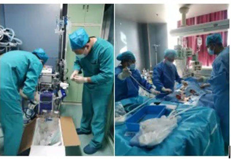 ecmo技术挽救急性大面积心梗,心源性休克,新冠ards患者