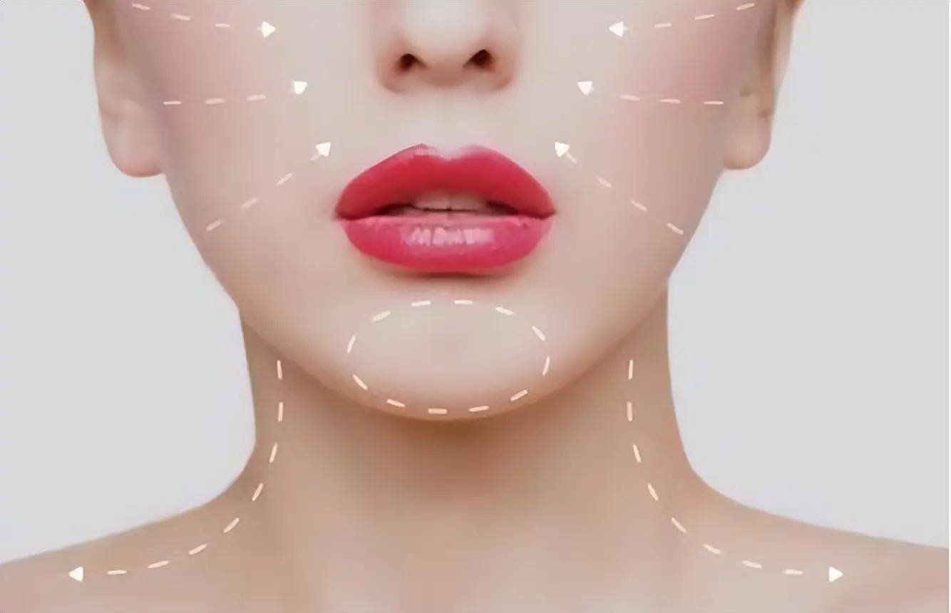 如何区分线雕大的v和小v区别是什么,线雕面部提升多久恢复自然_皮肤