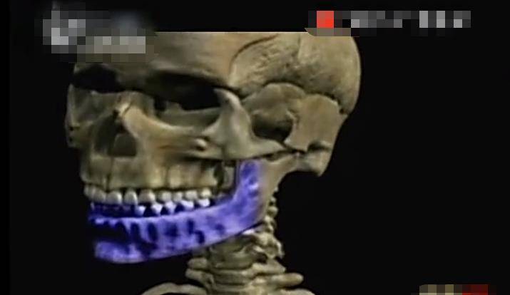 最初医生想到了使用肋骨,但是肋骨太薄了,日后的种植医治或者安装假牙