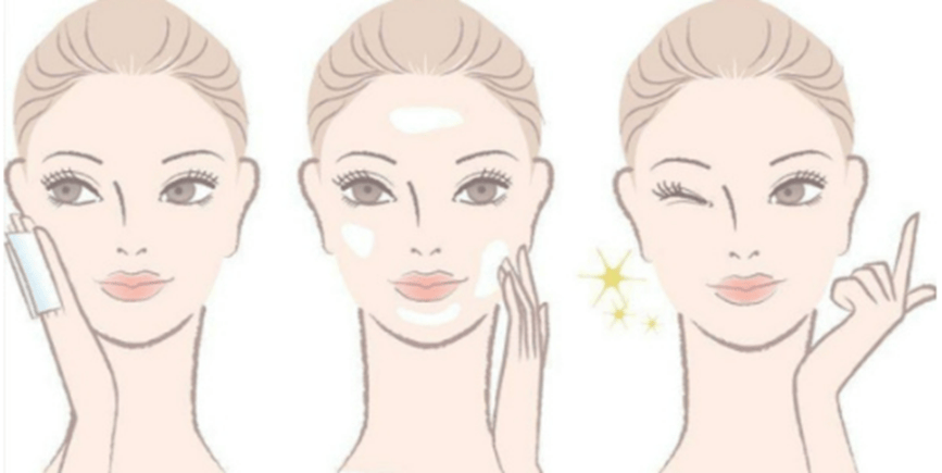 鱼尾纹怎么做效果最好?警惕15种雷区陷阱