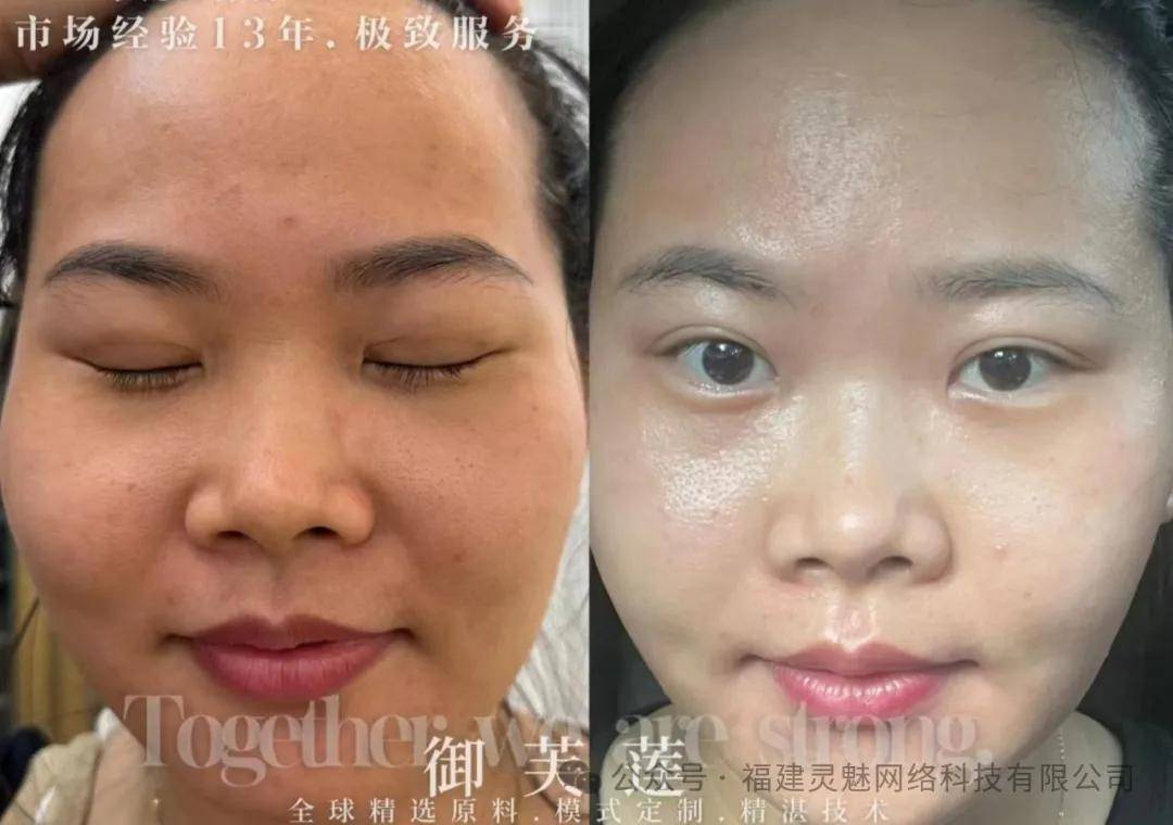 御芙莲护肤知识之精华液和霜的效果