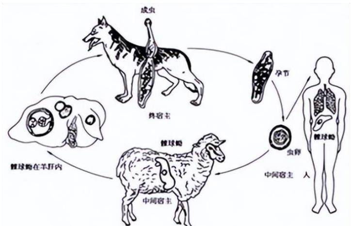 19年一藏族少女患"虫癌",医生开刀取出2斤虫子,最后结果如何