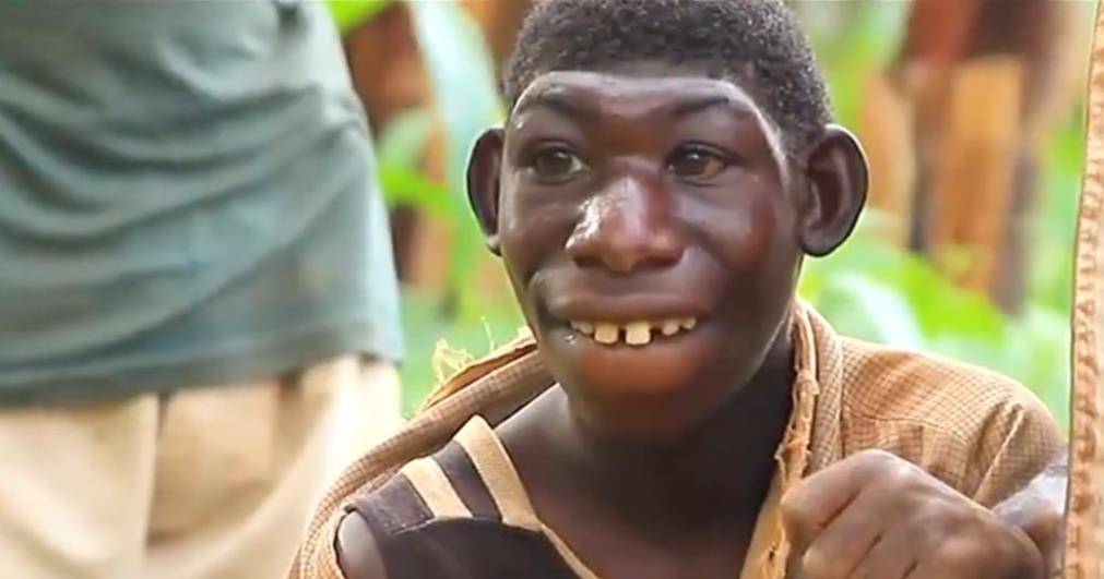 非洲一名24岁男孩,平时只吃水果,长相像猴子,一周能跑230公里