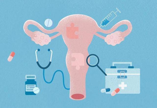 子宫脱垂:子宫下垂或移位的现象,常见于绝经后女性,可以引起腰酸背痛