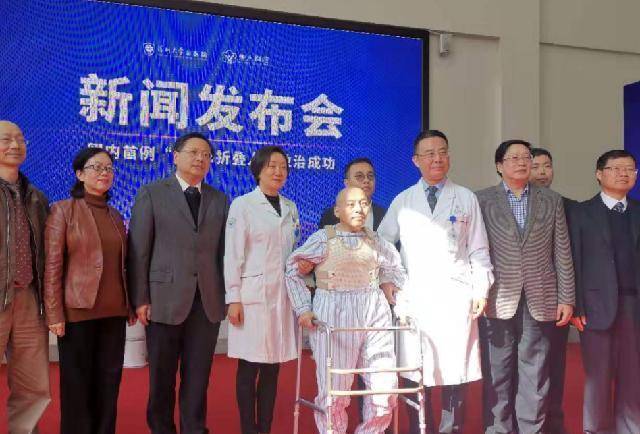 身体"折叠"28年,历经四次艰难手术,"折叠人"李华终重获新生