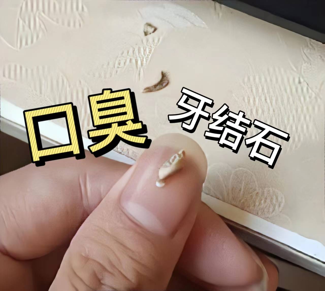 3步去除牙结石!简单有效不用洗牙!