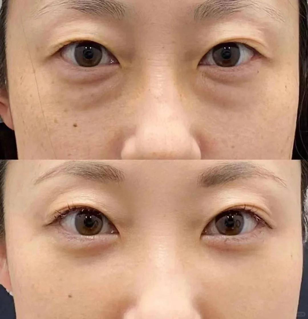 眼霜榜单:去眼袋公认最好用10大眼霜有哪些?