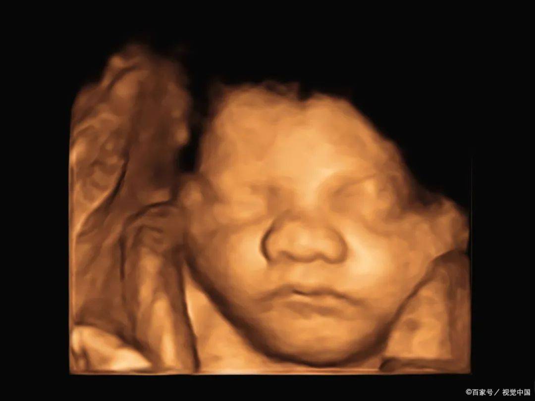 孕期必备!四维彩超全方位解析胎儿发育状态