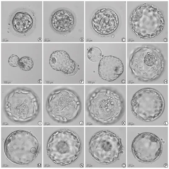生殖科普 | "试管"必知知识点:囊胚
