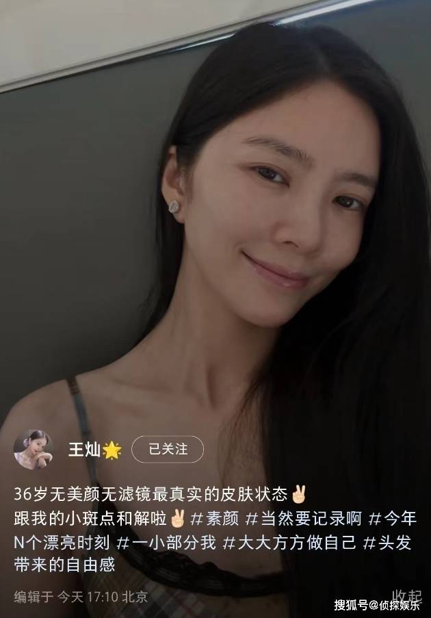 杜淳36岁娇妻自信晒全素颜,脸上斑点明显,但皮肤紧致看不到皱纹_王灿