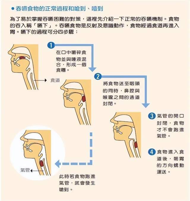 阳明扶正汤|运动神经元病|吞咽进食指南