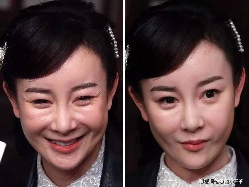 沉迷整容的4位女明星,有人"逆天改命"爆红,有人断送大好前程