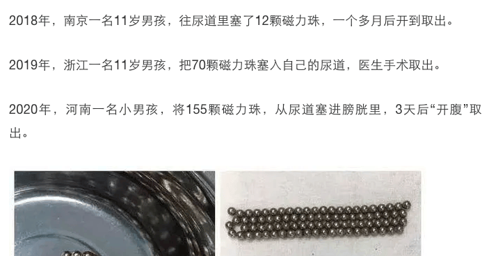 小孩子为啥不能玩磁力珠_小孩玩磁力珠对身体有害吗 小孩子为啥不能玩磁力珠_小孩玩磁力珠对身材
有害吗（小孩玩磁力珠对身体有害吗） 网络资讯