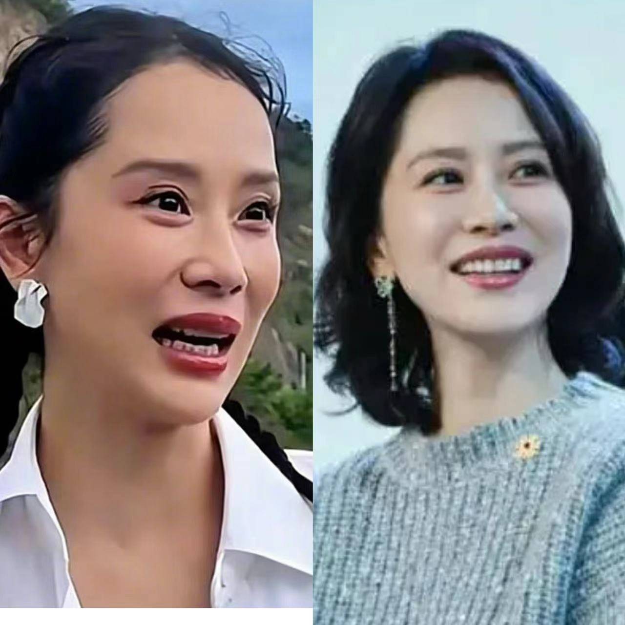 46岁海清近期妆容引热议,丰唇显著,网友质疑医美了