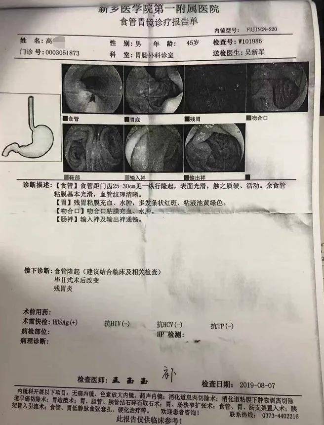 10年胃癌,手术 中药至今病情稳定!