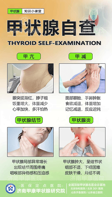 甲状腺自查摸哪个地方图片