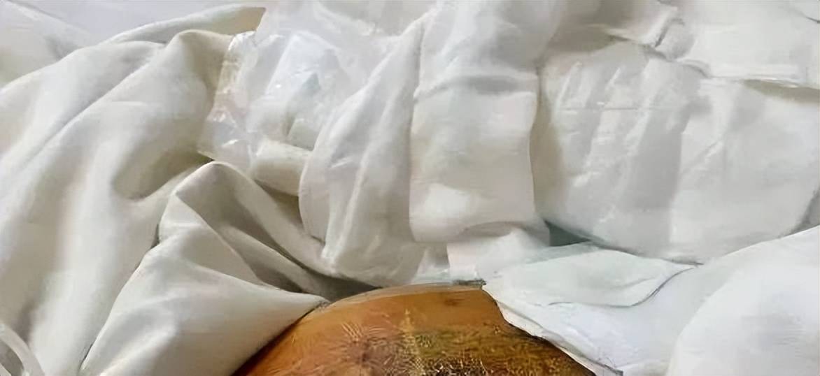 鼻子做歪投诉多 上海芙若拉医疗美容曾涉百万医疗事故(图13)