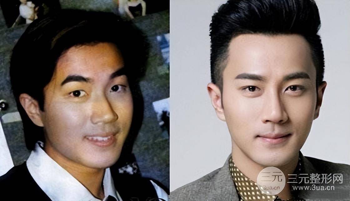 单眼皮_外貌_刘恺威