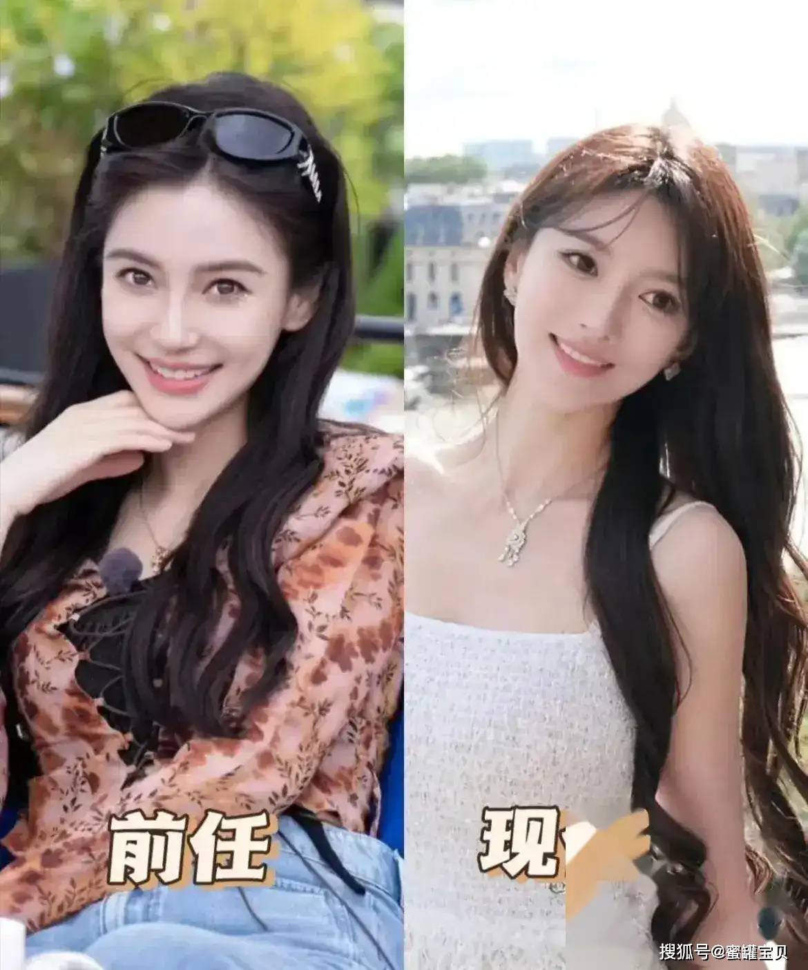 网红小影夫妇整容前后图片