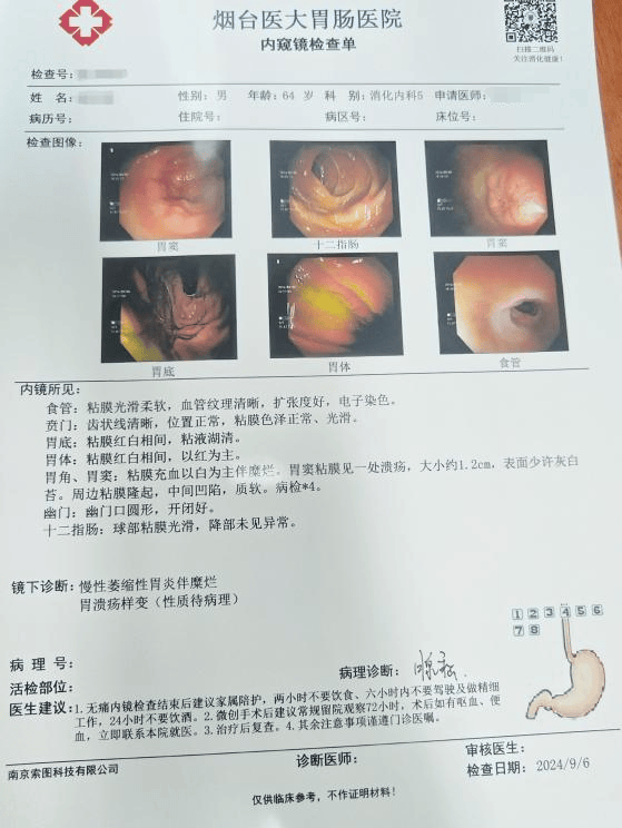 胃癌图片实拍 症状图片