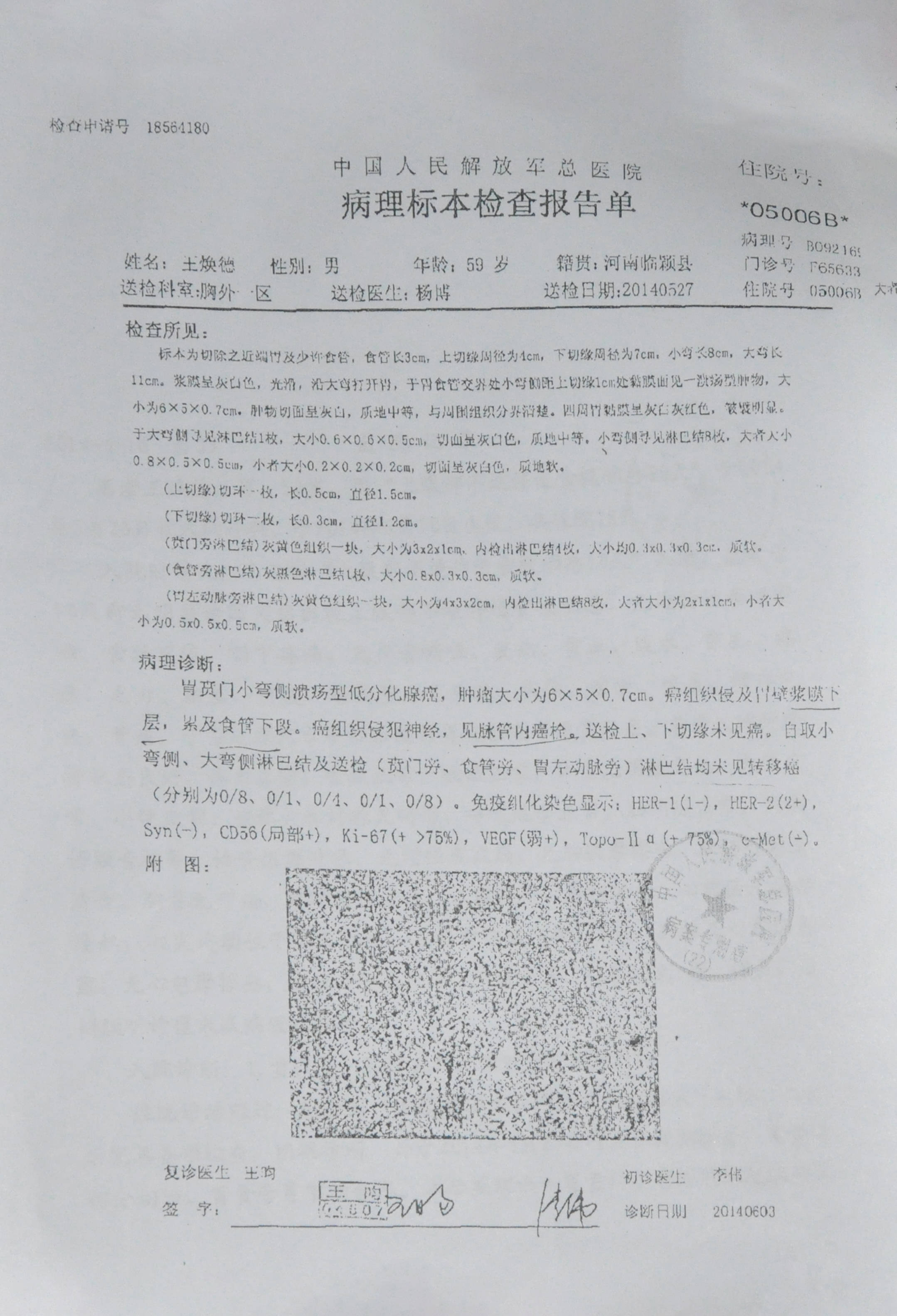 贲门癌治愈率图片