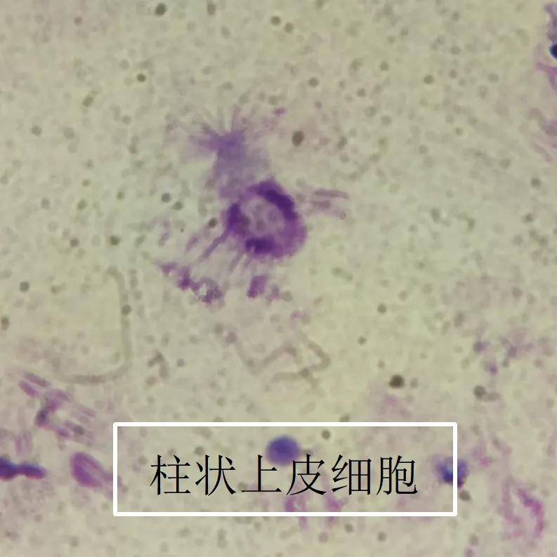 蠊缨滴虫确认这个物体正是经白孝成主管技师共同鉴别