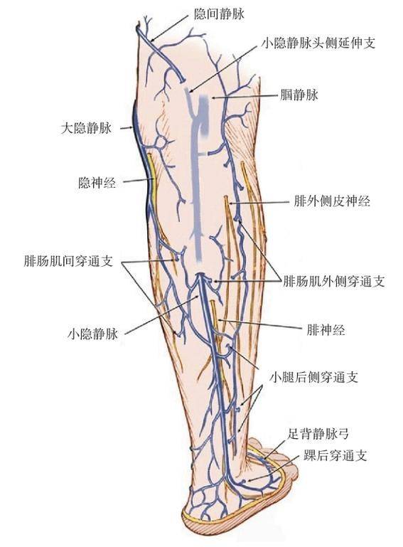 济南静脉曲张chiva中心:小隐静脉曲张的治疗与神经保护