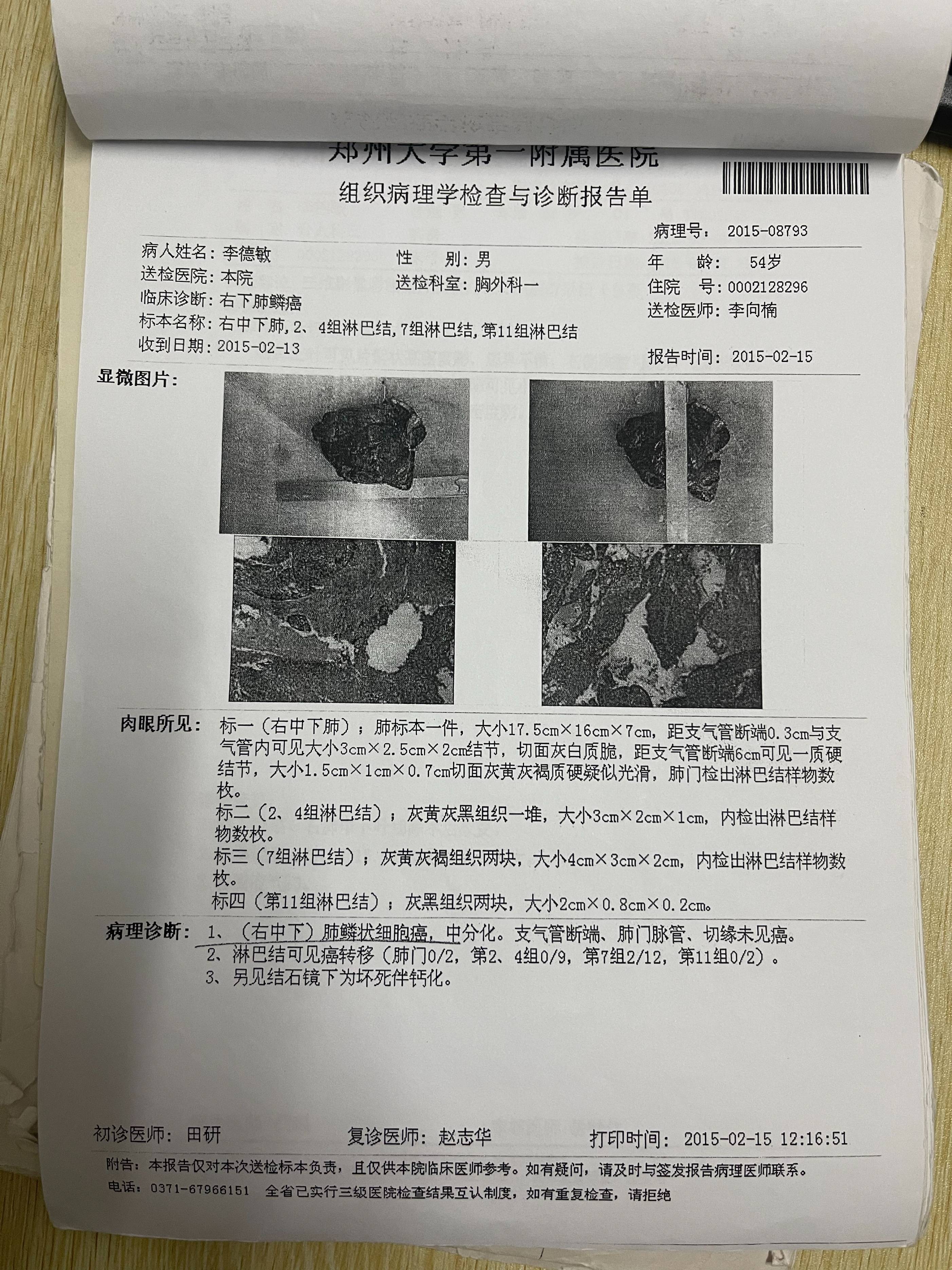 肺癌9年,他如今还能如常人般闲逛,钓鱼!