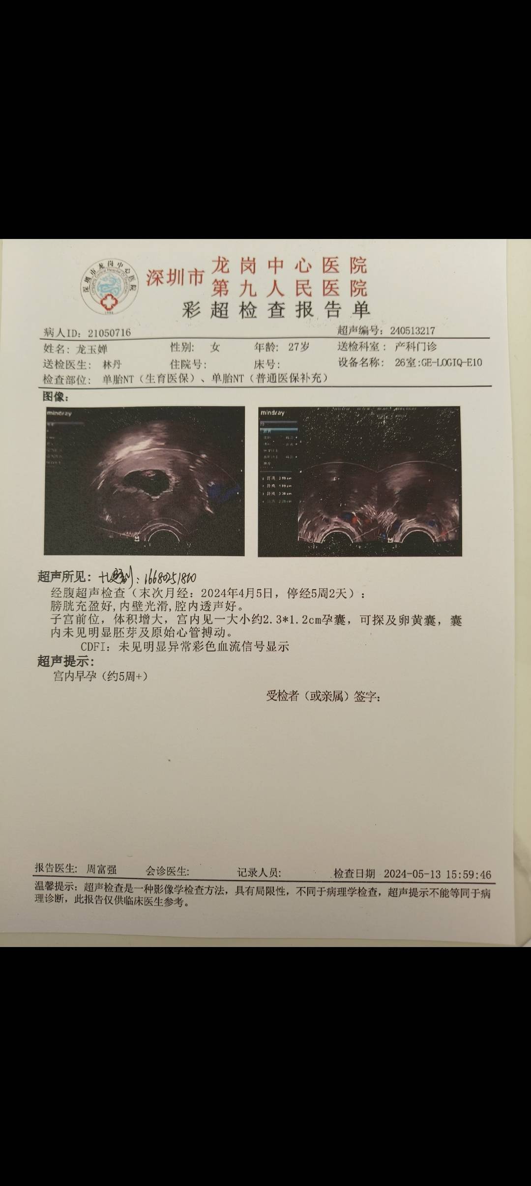 解读怀孕报告单 揭秘其中的关键信息