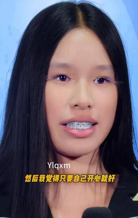 张庭女儿肤黑龅牙凸嘴,遭嘲笑,成最丑星二代